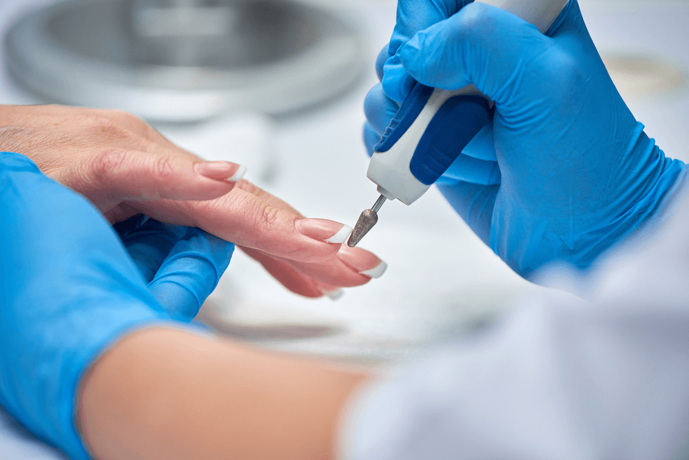 Técnicas de Acrygel